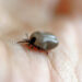 Small black tick on human skin, about to bite or crawl away.